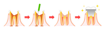 Tuft brush toothpaste leftover foodのイラスト素材
