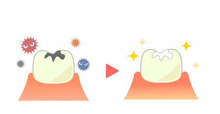 illustrations of dental sealants treatment before afterのイラスト素材