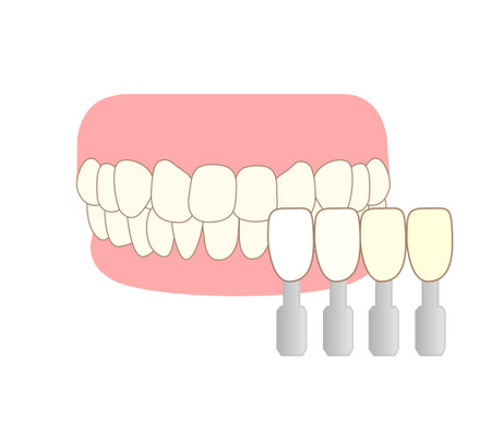 Mouthpiece and tooth wear and TCH stress temporomandibular joint diseaseのイラスト素材