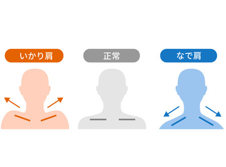 The difference between anchor shoulder and stroking shoulderのイラスト素材