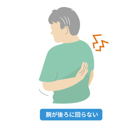 Illustration of a person whose shoulders hurt and his arms do not go backのイラスト素材