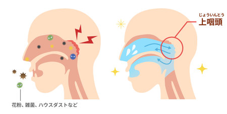 Effects and methods of nasal gargling How to clean the nasopharynxのイラスト素材