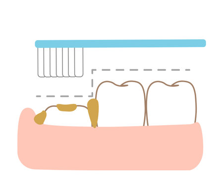 The gap between the 6-year-old molar teeth that are difficult to brush and brushingのイラスト素材