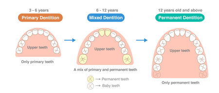 The number of teeth changing with age, the newly erupting teeth, and the alignment of the teeth.のイラスト素材