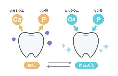 Expression set for the state of teeth and gumsのイラスト素材