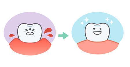 Expression set for the state of teeth and gumsのイラスト素材