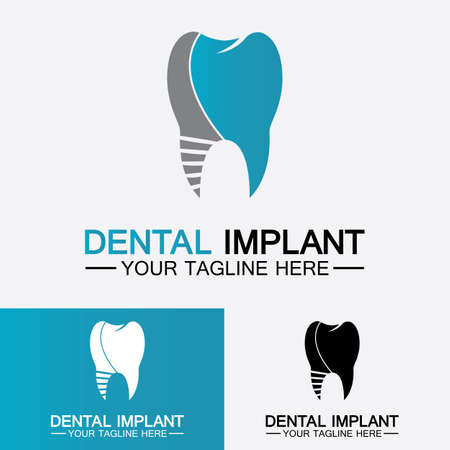 Dental implant logo vector  designs concept,  Dental Clinic &Care logo templateのイラスト素材