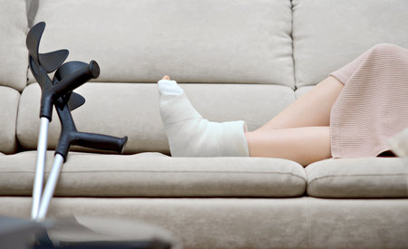 Closeup photo of broken female leg. Elbow crutches and orthopedic plaster. White ankle and foot splint bandages on the leg. Young woman's fall accident. Injury, trauma, recovery concept. Copy spaceの写真素材