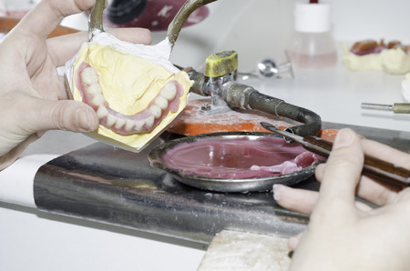 A dental technician working the gypsum model with wax.の写真素材