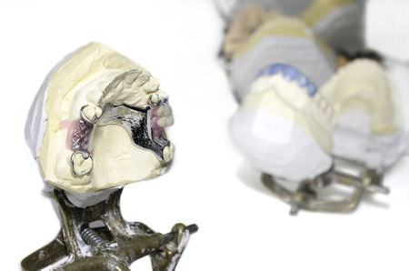 ceramic crowns in dental laboratoryの写真素材