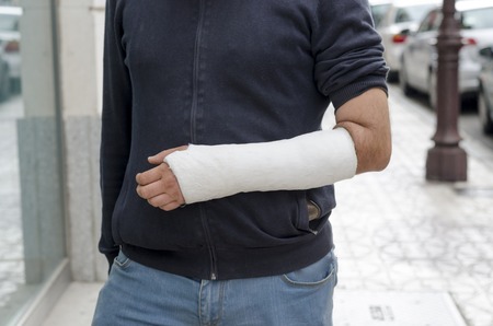 Man with his broken arm. Arm in cast, face not visible.の写真素材