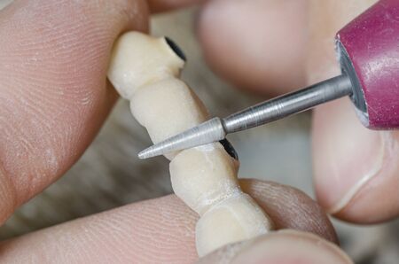 Dental technician is polishing a tooth model.