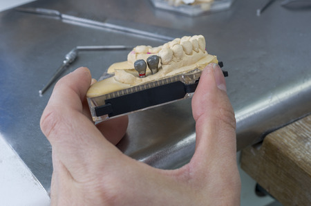 Dental technician is working with articulator in metal structure of a dental crown or bridge in dental laboratory.の写真素材