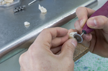 Dental technician is working with two tooth made in lithium disilicate with diamond discs in lab.