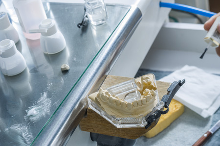 Closeup of dental technician applying ceramics to teeth before put into furnace