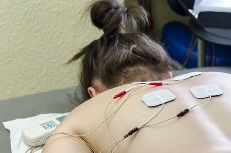 TENS electrodes positioned for back pain treatment in physical therapy.の写真素材