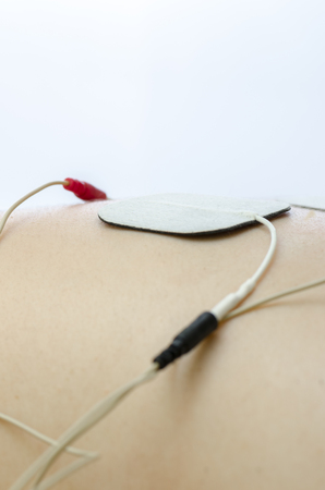 TENS electrodes positioned for back pain treatment in physical therapy.の写真素材