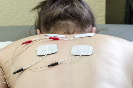 TENS electrodes positioned for back pain treatment in physical therapy.の写真素材