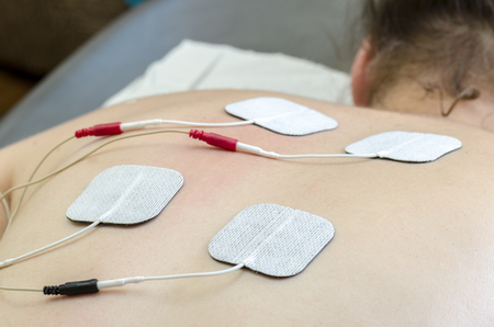 TENS electrodes positioned for back pain treatment in physical therapy.の写真素材