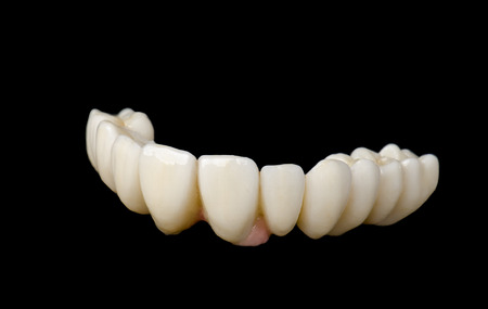 Monolithic zirconia restorations full arch implant supported with the ceramic load in vestibular, back background.の写真素材