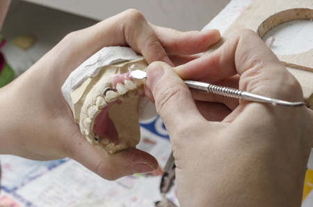 Dental technician doing partial dentures of acrylic resins in the lab.