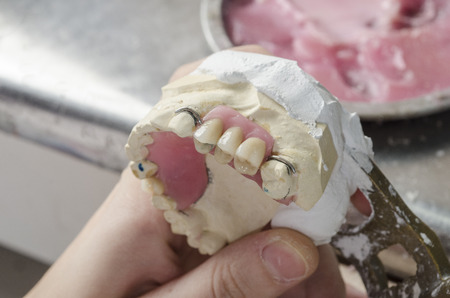 Dental technician doing partial dentures of acrylic resins in the lab.