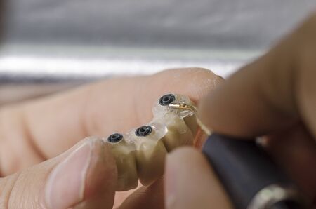 Dental technician applying shine of implant connection.の写真素材