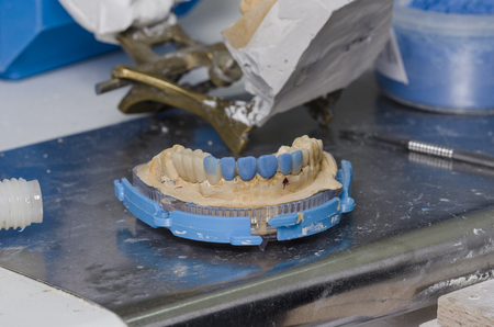 Dental lab technician produces a diagnostic wax-up.