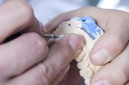 Dental technician working in a metal ceramic crowns.の写真素材