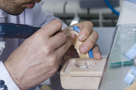 Dental technician working in a metal ceramic crowns.の写真素材