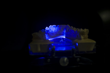Dental technician scanning a dental cast model in a 3D surface scanners.の写真素材