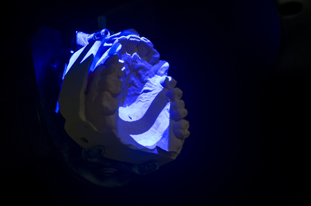 Dental technician scanning a dental cast model in a 3D surface scanners.の写真素材