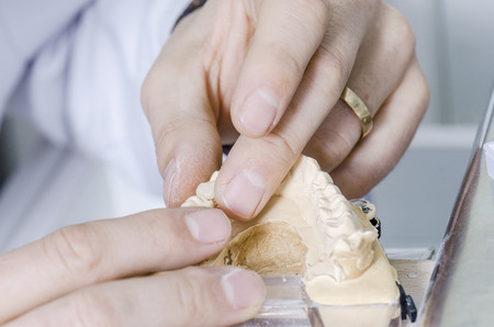 Dental technician putting a hybrid ceramic crown in a dental cast model.の写真素材