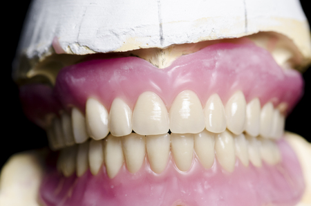 Closeup of dental prosthesis porcelain teeth in a mold.の写真素材