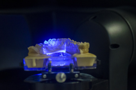 Dental technician scanning a dental cast model in a 3D surface scanners.