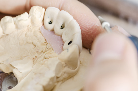 Dental technician working in a metal ceramic crowns.