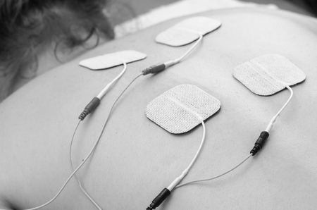 TENS electrodes positioned for back pain treatment in physical therapy.の写真素材