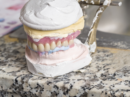 Dental prosthesis porcelain teeth in a cast mold.の写真素材