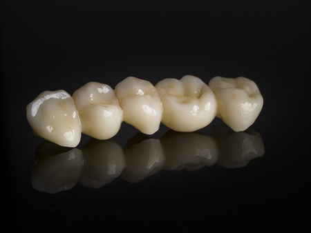 Monolithic zirconia restorations full arch implant supported with the ceramic load in vestibular,...