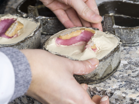 Dental technician is working with a dental flask of a complete upper on cast.の写真素材