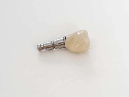 Implant of ceramic dental in a metal support.の写真素材