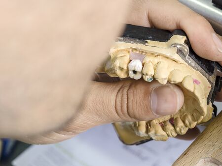 Closeup of dental technician applying ceramic to teeth, implant before putting into the furnace.の写真素材
