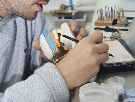 Technician dental is working with complete lower and upper metal ceramic prosthesis dental