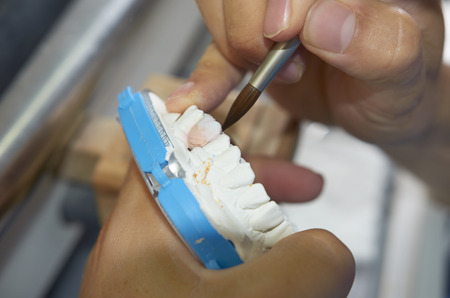 Dental technician using a brush with ceramic dental implants in his laboratory.
