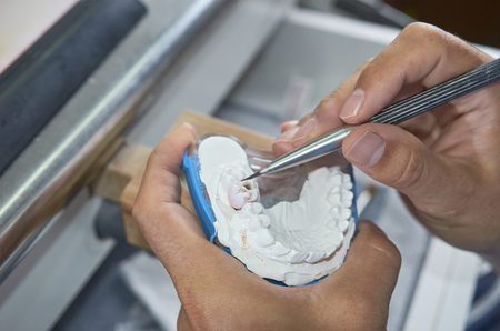 Dental technician working with tools to do ceramic dental implants in his laboratory.の写真素材