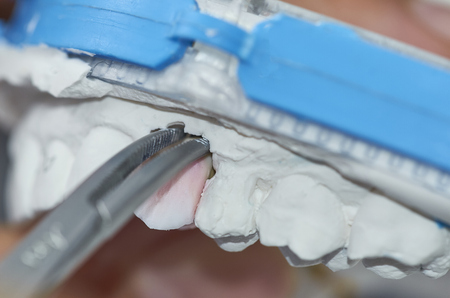 Closeup of dental technician putting ceramic to dental implants in his laboratory.の写真素材