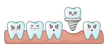 Healthy kawaii teeth are together and dental implant, cute cartoon characters, concept of dentistry and prosthetics - implant installation, teeth treatment, oral hygiene and dental care. Vector flatのイラスト素材