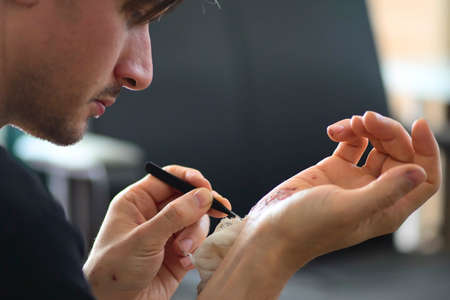 Abrasions on the palm and scratches on the right arm of an adult man. Home treatment. Self-removal of bandages using tweezers. Close-up.の写真素材