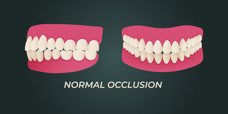 Vector illustration of orthodontic dentistry. Teeth and gums.