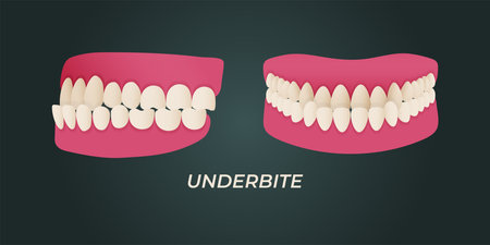 Illustration of a set of orthodontics. Vector illustration